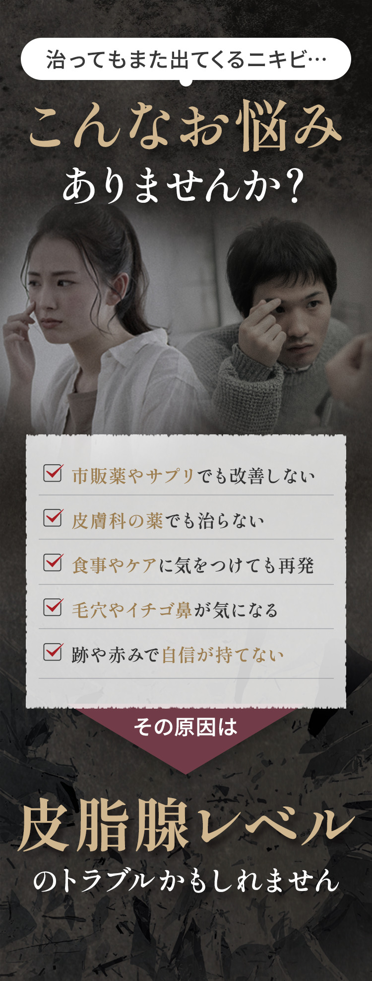 治ってもまた出てくるニキビ…その原因は皮脂腺レベルのトラブルかもしれません